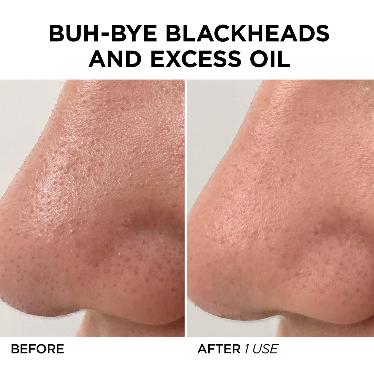 Femme - GLOFacial Pore Cleanser