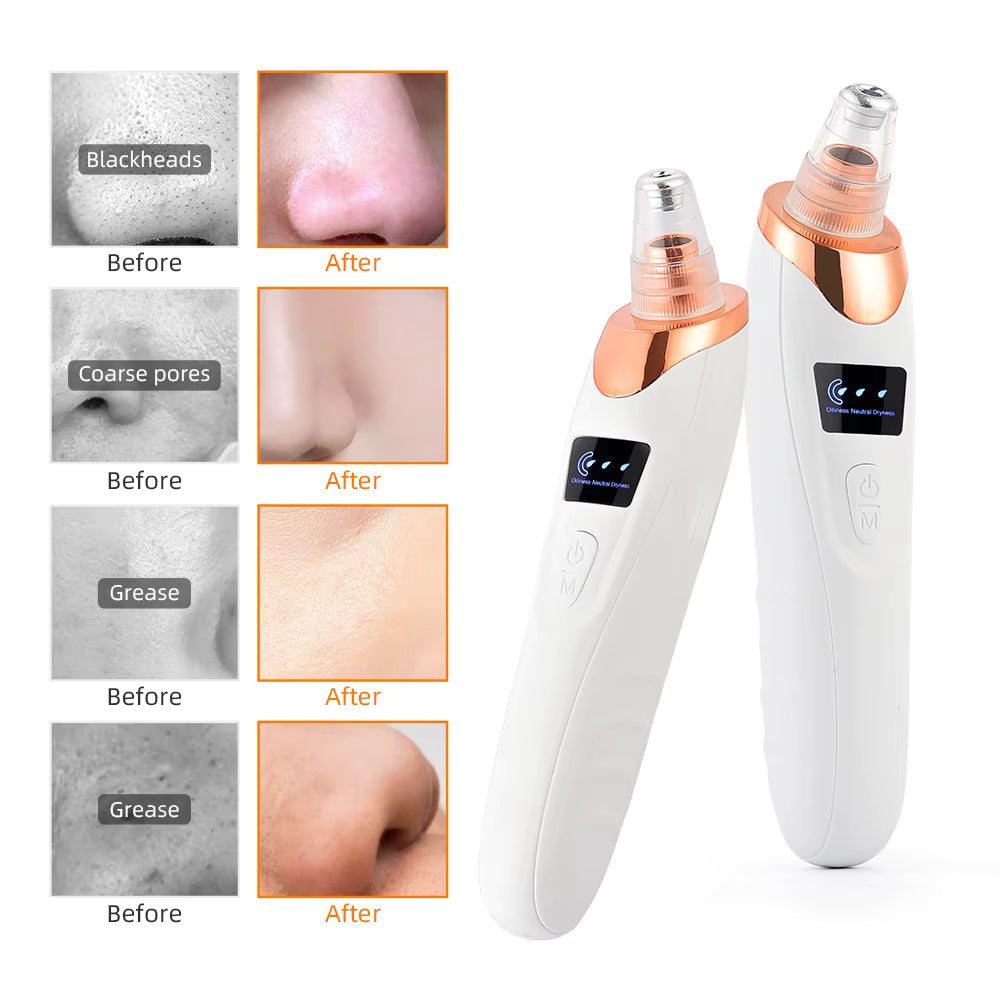 Femme - GLOFacial Pore Cleanser